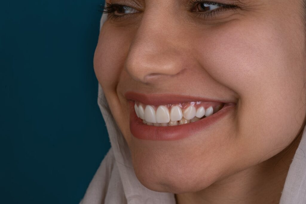 3-5 day implant bridges