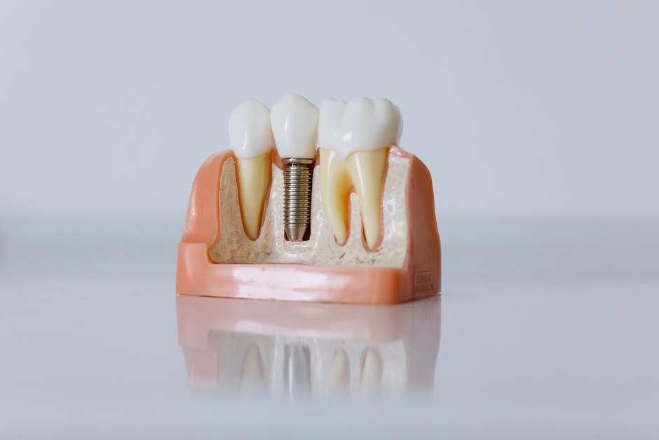 all on 4 dental implants zirconia
